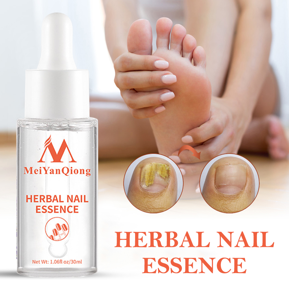 เจลบำรุงเท้า แอนตี้ เนล ไวท์เท - Mens Grooming Treatment บทวิจารณ์และราคา